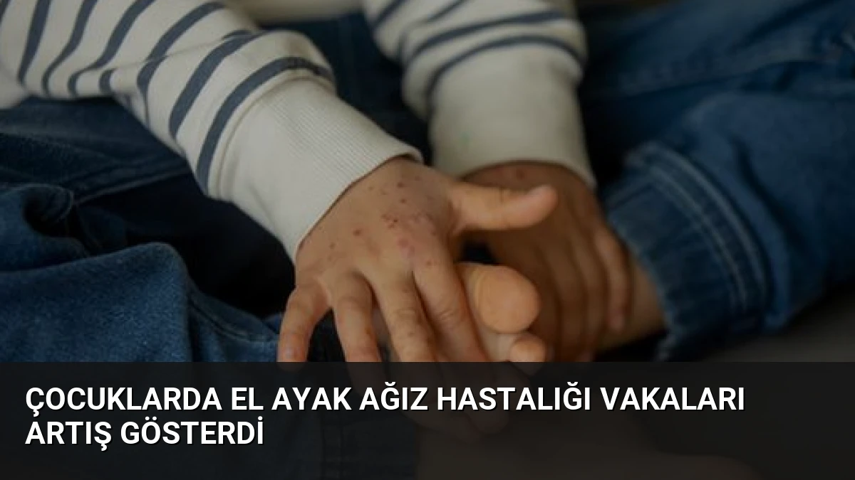 Çocuklarda El Ayak Ağız Hastalığı Vakaları Artış Gösterdi