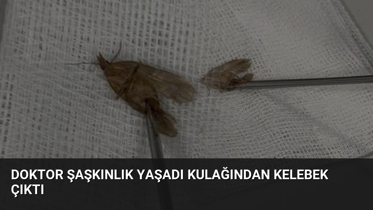 Doktor Şaşkınlık Yaşadı Kulağından Kelebek Çıktı